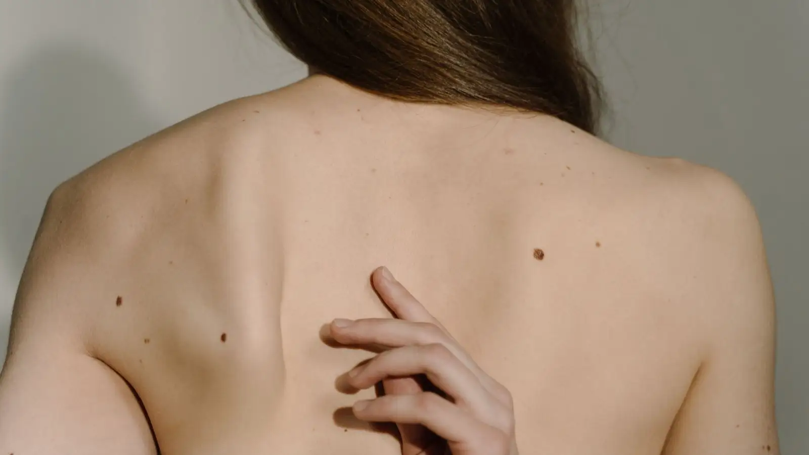 Gros plan sur un grain de beauté brun observé à la loupe lors d'une consultation dermatologique.